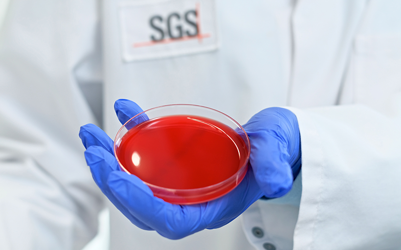 SGS HE Laboratory Doing Clinical Hygiene Testing in Markkleeberg, Germany